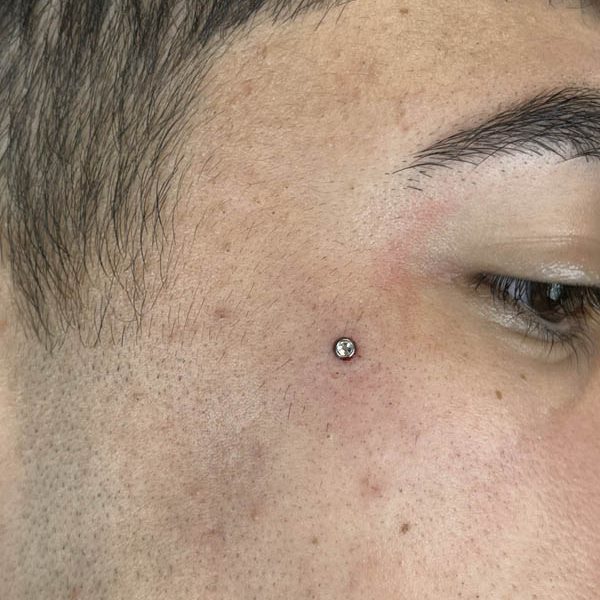 microdermal